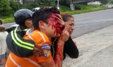 Un menor perdió los ojos por la represión en Venezuela