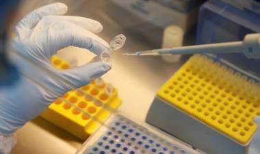 Rusia planea aprobar y comenzar a utilizar una vacuna contra el coronavirus en agosto y sin terminar las pruebas