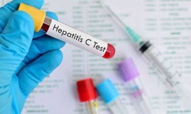 Anmat aprobó una prueba rápida para la detección de la hepatitis C