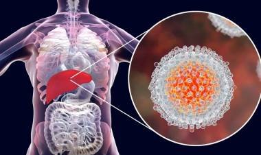 Detectaron en el país el primer caso de hepatitis aguda grave de origen desconocido