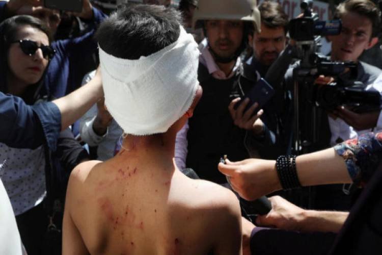 Al menos 11 muertos y 65 heridos tras un ataque en Kabul